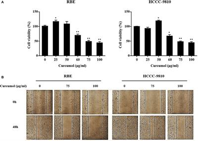 Curcumol Exerts Anticancer Effect in Cholangiocarcinoma Cells via Down-Regulating CDKL3